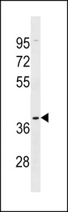 OR5AK2 Antibody - OR5AK2 Antibody western blot of A375 cell line lysates (35 ug/lane). The OR5AK2 antibody detected the OR5AK2 protein (arrow).