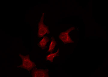 OR5AK3P Antibody - Staining HuvEc cells by IF/ICC. The samples were fixed with PFA and permeabilized in 0.1% Triton X-100, then blocked in 10% serum for 45 min at 25°C. The primary antibody was diluted at 1:200 and incubated with the sample for 1 hour at 37°C. An Alexa Fluor 594 conjugated goat anti-rabbit IgG (H+L) Ab, diluted at 1/600, was used as the secondary antibody.