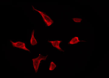 OR5AR1 Antibody - Staining HeLa cells by IF/ICC. The samples were fixed with PFA and permeabilized in 0.1% Triton X-100, then blocked in 10% serum for 45 min at 25°C. The primary antibody was diluted at 1:200 and incubated with the sample for 1 hour at 37°C. An Alexa Fluor 594 conjugated goat anti-rabbit IgG (H+L) Ab, diluted at 1/600, was used as the secondary antibody.
