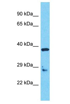 OR5AU1 Antibody - OR5AU1 antibody Western Blot of RPMI-8226. Antibody dilution: 1 ug/ml.  This image was taken for the unconjugated form of this product. Other forms have not been tested.