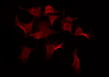 OR5AU1 Antibody - Staining HeLa cells by IF/ICC. The samples were fixed with PFA and permeabilized in 0.1% Triton X-100, then blocked in 10% serum for 45 min at 25°C. The primary antibody was diluted at 1:200 and incubated with the sample for 1 hour at 37°C. An Alexa Fluor 594 conjugated goat anti-rabbit IgG (H+L) Ab, diluted at 1/600, was used as the secondary antibody.