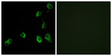 OR5B12 Antibody - Immunofluorescence analysis of COS7 cells, using OR5B12 Antibody. The picture on the right is blocked with the synthesized peptide.
