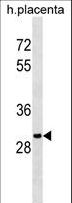 OR5B12 Antibody - OR5B12 Antibody western blot of human placenta tissue lysates (35 ug/lane). The OR5B12 antibody detected the OR5B12 protein (arrow).