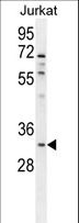 OR5B12 Antibody - OR5B12 Antibody western blot of Jurkat cell line lysates (35 ug/lane). The OR5B12 antibody detected the OR5B12 protein (arrow).