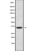 OR5B12 Antibody - Western blot analysis Olfactory receptor 5B12 using A549 whole cells lysates