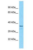 OR5B3 Antibody - OR5B3 antibody Western Blot of COLO205. Antibody dilution: 1 ug/ml.  This image was taken for the unconjugated form of this product. Other forms have not been tested.