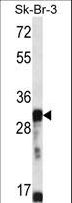 OR5D13 Antibody - OR5D13 Antibody western blot of SK-BR-3 cell line lysates (35 ug/lane). The OR5D13 antibody detected the OR5D13 protein (arrow).