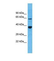 OR5D13 Antibody - Western blot of Human Fetal Kidney. OR5D13 antibody dilution 1.0 ug/ml.  This image was taken for the unconjugated form of this product. Other forms have not been tested.