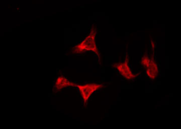 OR5D13 Antibody - Staining HeLa cells by IF/ICC. The samples were fixed with PFA and permeabilized in 0.1% Triton X-100, then blocked in 10% serum for 45 min at 25°C. The primary antibody was diluted at 1:200 and incubated with the sample for 1 hour at 37°C. An Alexa Fluor 594 conjugated goat anti-rabbit IgG (H+L) Ab, diluted at 1/600, was used as the secondary antibody.
