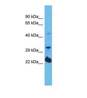 OR5D14 Antibody - Western blot of Human 293T. OR5D14 antibody dilution 1.0 ug/ml.  This image was taken for the unconjugated form of this product. Other forms have not been tested.