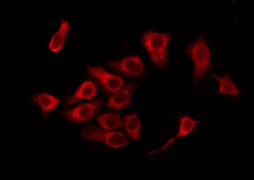 OR5D16 Antibody - Staining MCF-7 cells by IF/ICC. The samples were fixed with PFA and permeabilized in 0.1% Triton X-100, then blocked in 10% serum for 45 min at 25°C. The primary antibody was diluted at 1:200 and incubated with the sample for 1 hour at 37°C. An Alexa Fluor 594 conjugated goat anti-rabbit IgG (H+L) Ab, diluted at 1/600, was used as the secondary antibody.