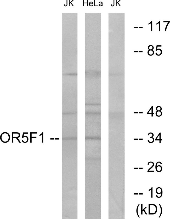 OR5F1 Antibody - Western blot analysis of lysates from HeLa and Jurkat cells, using OR5F1 Antibody. The lane on the right is blocked with the synthesized peptide.