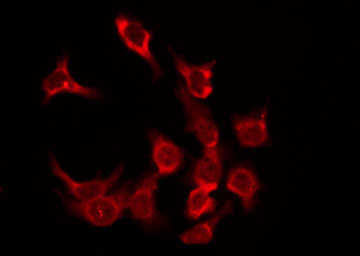 OR5F1 Antibody - Staining HeLa cells by IF/ICC. The samples were fixed with PFA and permeabilized in 0.1% Triton X-100, then blocked in 10% serum for 45 min at 25°C. The primary antibody was diluted at 1:200 and incubated with the sample for 1 hour at 37°C. An Alexa Fluor 594 conjugated goat anti-rabbit IgG (H+L) Ab, diluted at 1/600, was used as the secondary antibody.