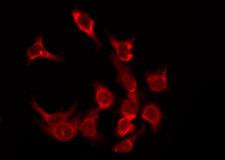 OR5F1 Antibody - Staining HeLa cells by IF/ICC. The samples were fixed with PFA and permeabilized in 0.1% Triton X-100, then blocked in 10% serum for 45 min at 25°C. The primary antibody was diluted at 1:200 and incubated with the sample for 1 hour at 37°C. An Alexa Fluor 594 conjugated goat anti-rabbit IgG (H+L) Ab, diluted at 1/600, was used as the secondary antibody.