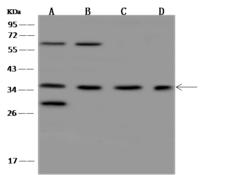 OR5F1 Antibody - Anti-OR5F1 rabbit polyclonal antibody at 1:500 dilution. Lane A: Hela Whole Cell Lysate. Lane B: Jurkat Whole Cell Lysate. Lane C: HL60 Whole Cell Lysate. Lane D: COLO205 Whole Cell Lysate. Lysates/proteins at 30 ug per lane. Secondary: Goat Anti-Rabbit IgG (H+L)/HRP at 1/10000 dilution. Developed using the ECL technique. Performed under reducing conditions. Predicted band size: 35 kDa. Observed band size: 35 kDa. (We are unsure as to the identity of these extra bands.)