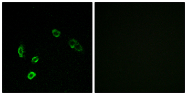 OR5H1 Antibody - Immunofluorescence analysis of MCF7 cells, using OR5H15 Antibody. The picture on the right is blocked with the synthesized peptide.
