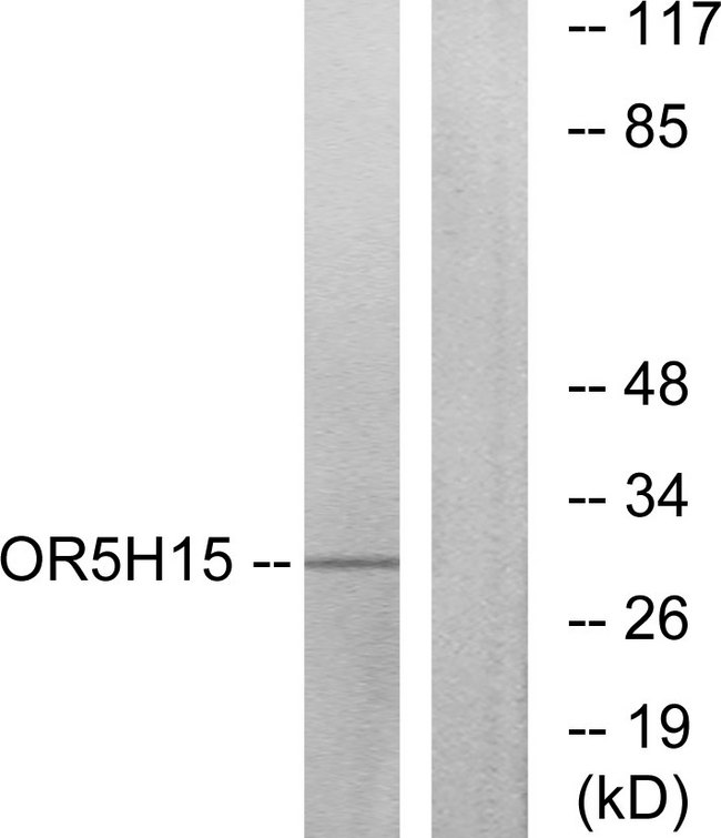OR5H1 Antibody - Western blot analysis of lysates from COLO cells, using OR5H15 Antibody. The lane on the right is blocked with the synthesized peptide.