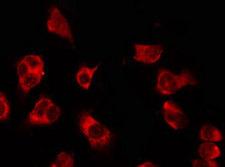 OR5H1 Antibody - Staining HeLa cells by IF/ICC. The samples were fixed with PFA and permeabilized in 0.1% Triton X-100, then blocked in 10% serum for 45 min at 25°C. The primary antibody was diluted at 1:200 and incubated with the sample for 1 hour at 37°C. An Alexa Fluor 594 conjugated goat anti-rabbit IgG (H+L) Ab, diluted at 1/600, was used as the secondary antibody.