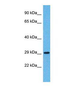 OR5H14 Antibody - Western blot of Human Jurkat. OR5H14 antibody dilution 1.0 ug/ml.  This image was taken for the unconjugated form of this product. Other forms have not been tested.
