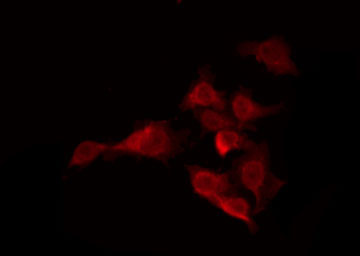 OR5H15 Antibody - Staining COLO205 cells by IF/ICC. The samples were fixed with PFA and permeabilized in 0.1% Triton X-100, then blocked in 10% serum for 45 min at 25°C. The primary antibody was diluted at 1:200 and incubated with the sample for 1 hour at 37°C. An Alexa Fluor 594 conjugated goat anti-rabbit IgG (H+L) Ab, diluted at 1/600, was used as the secondary antibody.