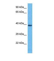 OR5H2 Antibody - Western blot of Human Jurkat. OR5H2 antibody dilution 1.0 ug/ml.  This image was taken for the unconjugated form of this product. Other forms have not been tested.