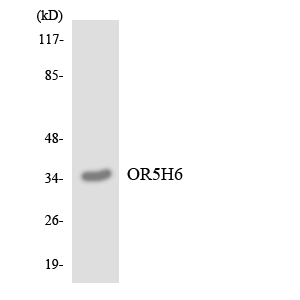 OR5H6 Antibody - Western blot analysis of the lysates from COLO205 cells using OR5H6 antibody.
