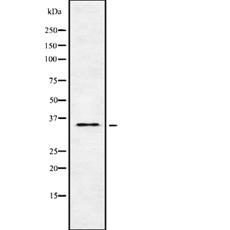 OR5H6 Antibody - Western blot analysis OR5H6 using Jurkat whole cells lysates