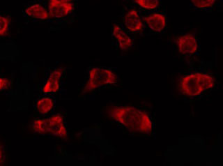 OR5H6 Antibody - Staining HeLa cells by IF/ICC. The samples were fixed with PFA and permeabilized in 0.1% Triton X-100, then blocked in 10% serum for 45 min at 25°C. The primary antibody was diluted at 1:200 and incubated with the sample for 1 hour at 37°C. An Alexa Fluor 594 conjugated goat anti-rabbit IgG (H+L) Ab, diluted at 1/600, was used as the secondary antibody.