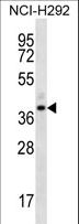 OR5I1 / OR5I Antibody - OR5I1 Antibody western blot of NCI-H292 cell line lysates (35 ug/lane). The OR5I1 antibody detected the OR5I1 protein (arrow).