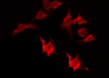 OR5I1 / OR5I Antibody - Staining HepG2 cells by IF/ICC. The samples were fixed with PFA and permeabilized in 0.1% Triton X-100, then blocked in 10% serum for 45 min at 25°C. The primary antibody was diluted at 1:200 and incubated with the sample for 1 hour at 37°C. An Alexa Fluor 594 conjugated goat anti-rabbit IgG (H+L) Ab, diluted at 1/600, was used as the secondary antibody.