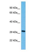 OR5J2 Antibody - OR5J2 antibody Western Blot of Fetal Lung. Antibody dilution: 1 ug/ml.  This image was taken for the unconjugated form of this product. Other forms have not been tested.