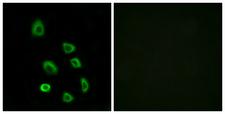 OR5K1 Antibody - Immunofluorescence analysis of HUVEC cells, using OR5K1 Antibody. The picture on the right is blocked with the synthesized peptide.