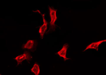 OR5K3 Antibody - Staining HeLa cells by IF/ICC. The samples were fixed with PFA and permeabilized in 0.1% Triton X-100, then blocked in 10% serum for 45 min at 25°C. The primary antibody was diluted at 1:200 and incubated with the sample for 1 hour at 37°C. An Alexa Fluor 594 conjugated goat anti-rabbit IgG (H+L) Ab, diluted at 1/600, was used as the secondary antibody.