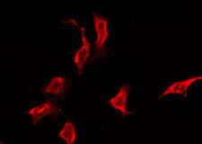 OR5K3 Antibody - Staining HeLa cells by IF/ICC. The samples were fixed with PFA and permeabilized in 0.1% Triton X-100, then blocked in 10% serum for 45 min at 25°C. The primary antibody was diluted at 1:200 and incubated with the sample for 1 hour at 37°C. An Alexa Fluor 594 conjugated goat anti-rabbit IgG (H+L) Ab, diluted at 1/600, was used as the secondary antibody.