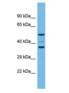 OR5K4 Antibody - OR5K4 antibody Western Blot of Fetal Kidney. Antibody dilution: 1 ug/ml.  This image was taken for the unconjugated form of this product. Other forms have not been tested.