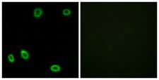OR5L1+2 Antibody - Peptide - + Immunofluorescence analysis of HuvEc cells, using OR5L1/2 antibody.