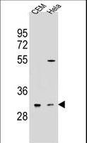 OR5L2 Antibody - OR5L2 Antibody western blot of CEM,HeLa cell line lysates (35 ug/lane). The OR5L2 antibody detected the OR5L2 protein (arrow).