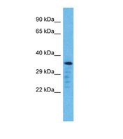 OR5L2 Antibody - Western blot of Human Jurkat. OR5L2 antibody dilution 1.0 ug/ml.  This image was taken for the unconjugated form of this product. Other forms have not been tested.