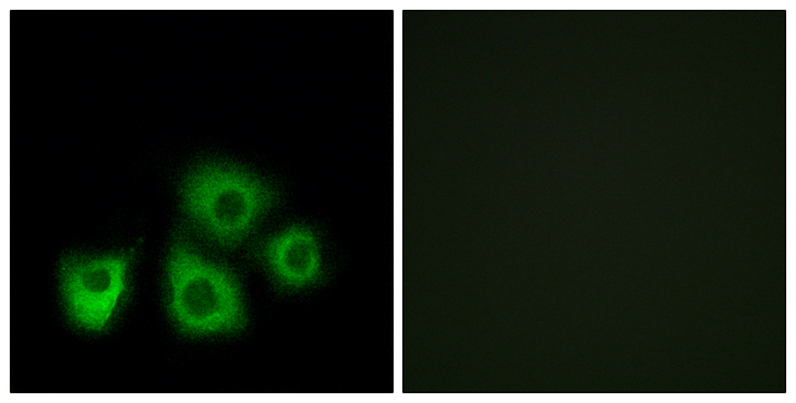 OR5M1+10 Antibody - Immunofluorescence analysis of MCF7 cells, using OR5M1/5M10 Antibody. The picture on the right is blocked with the synthesized peptide.