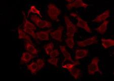 OR5M1 Antibody - Staining HeLa cells by IF/ICC. The samples were fixed with PFA and permeabilized in 0.1% Triton X-100, then blocked in 10% serum for 45 min at 25°C. The primary antibody was diluted at 1:200 and incubated with the sample for 1 hour at 37°C. An Alexa Fluor 594 conjugated goat anti-rabbit IgG (H+L) Ab, diluted at 1/600, was used as the secondary antibody.