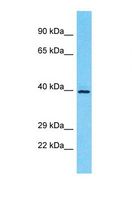 OR5M10 Antibody - Western blot of Human Jurkat. OR5M10 antibody dilution 1.0 ug/ml.  This image was taken for the unconjugated form of this product. Other forms have not been tested.