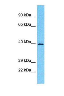 OR5M10 Antibody - Western blot of Human Jurkat. OR5M10 antibody dilution 1.0 ug/ml.  This image was taken for the unconjugated form of this product. Other forms have not been tested.