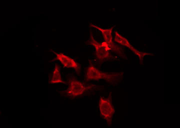 OR5M11 Antibody - Staining HuvEc cells by IF/ICC. The samples were fixed with PFA and permeabilized in 0.1% Triton X-100, then blocked in 10% serum for 45 min at 25°C. The primary antibody was diluted at 1:200 and incubated with the sample for 1 hour at 37°C. An Alexa Fluor 594 conjugated goat anti-rabbit IgG (H+L) Ab, diluted at 1/600, was used as the secondary antibody.