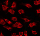 OR5M3 Antibody - Staining HepG2 cells by IF/ICC. The samples were fixed with PFA and permeabilized in 0.1% Triton X-100, then blocked in 10% serum for 45 min at 25°C. The primary antibody was diluted at 1:200 and incubated with the sample for 1 hour at 37°C. An Alexa Fluor 594 conjugated goat anti-rabbit IgG (H+L) Ab, diluted at 1/600, was used as the secondary antibody.