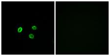 OR5M9 Antibody - Immunofluorescence analysis of MCF7 cells, using OR5M9 Antibody. The picture on the right is blocked with the synthesized peptide.