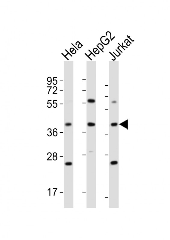 OR5M9 Antibody - All lanes : Anti-OR5M9 Antibody at 1:4000 dilution Lane 1: HeLa whole cell lysates Lane 2: HepG2 whole cell lysates Lane 3: Jurkat whole cell lysates Lysates/proteins at 20 ug per lane. Secondary Goat Anti-Rabbit IgG, (H+L), Peroxidase conjugated at 1/10000 dilution Predicted band size : 35 kDa Blocking/Dilution buffer: 5% NFDM/TBST.