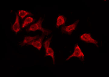 OR5M9 Antibody - Staining HeLa cells by IF/ICC. The samples were fixed with PFA and permeabilized in 0.1% Triton X-100, then blocked in 10% serum for 45 min at 25°C. The primary antibody was diluted at 1:200 and incubated with the sample for 1 hour at 37°C. An Alexa Fluor 594 conjugated goat anti-rabbit IgG (H+L) Ab, diluted at 1/600, was used as the secondary antibody.