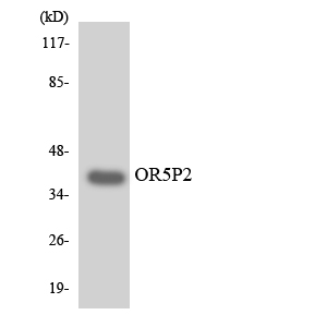 OR5P2 Antibody - Western blot analysis of the lysates from K562 cells using OR5P2 antibody.