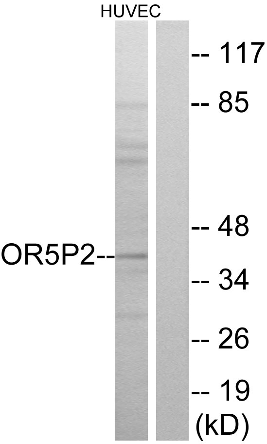 OR5P2 Antibody - Western blot analysis of lysates from HUVEC cells, using OR5P2 Antibody. The lane on the right is blocked with the synthesized peptide.