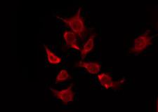 OR5P2 Antibody - Staining HuvEc cells by IF/ICC. The samples were fixed with PFA and permeabilized in 0.1% Triton X-100, then blocked in 10% serum for 45 min at 25°C. The primary antibody was diluted at 1:200 and incubated with the sample for 1 hour at 37°C. An Alexa Fluor 594 conjugated goat anti-rabbit IgG (H+L) Ab, diluted at 1/600, was used as the secondary antibody.